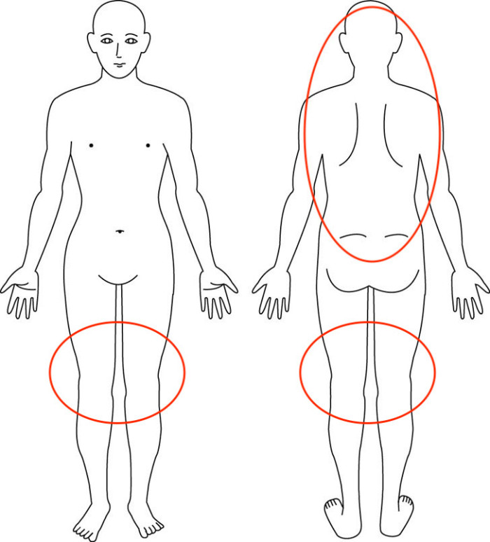 【症例】産後に多い反り腰が影響してた膝や腰の痛みが緩和