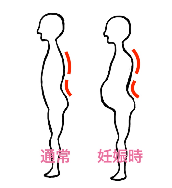 妊娠中の股関節痛